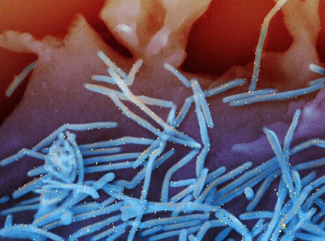 Hình ảnh virus RSV dưới kính hiển vi